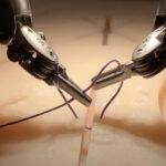 Quand les robots deviennent chirurgiens !